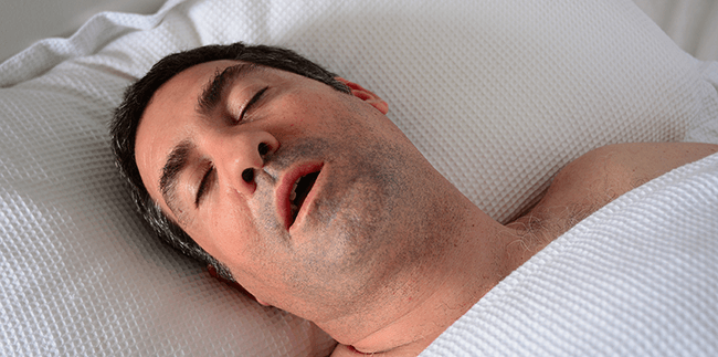 Effect of RMT on Sleep Architecture in Obstructive Sleep Apnea