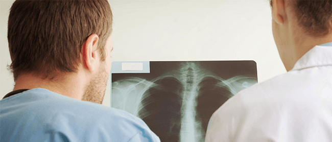 Effect of Pulmonary Rehabilitation with RMT on the Impact of COPD on Healthcare Resources